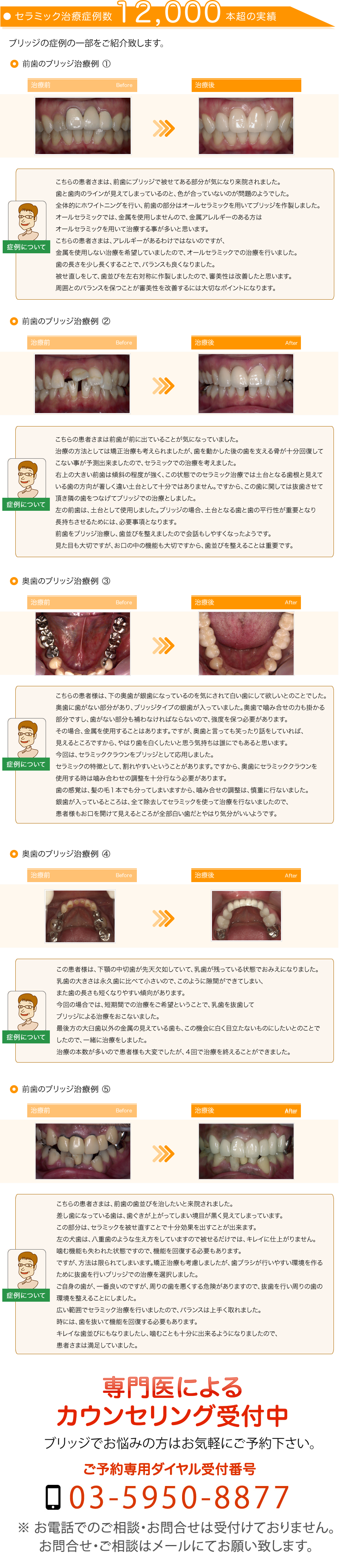 ブリッジ治療 歯1本あたり49 800円 ブリッジ専門外来 白い差し歯